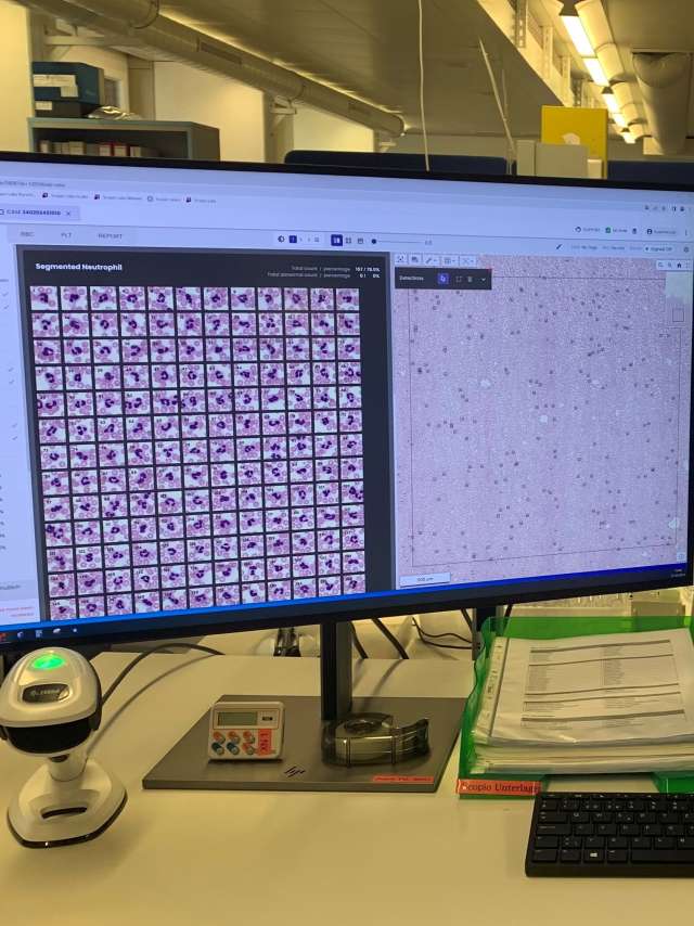Digitale, KI-gestützte Vollfeld-Blutbilddiagnostik im Zentrum für Labormedizin